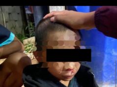 Sadis! Anak 13 Tahun Dianiaya Berat di Ketapang, Polisi Tangani Kasusnya