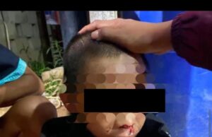 Sadis! Anak 13 Tahun Dianiaya Berat di Ketapang, Polisi Tangani Kasusnya